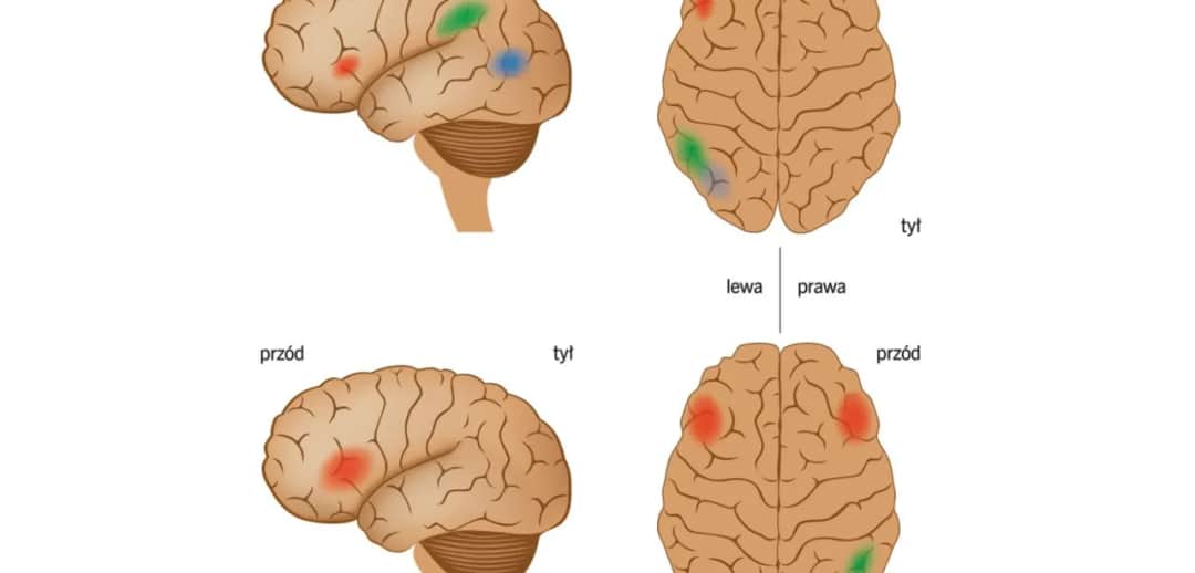 Zespół Aspergera a dysleksja: Czy mogą występować razem?